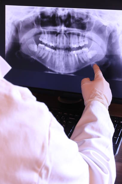 Best Broken or Cracked Tooth Emergency Dentist in Heathcote, NJ