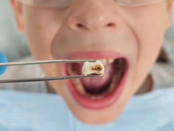Best Emergency Dentist for Knocked-Out Tooth in Heathcote, NJ