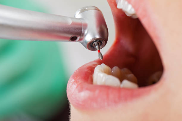 Best Emergency Dental Care for Abscessed Tooth in Heathcote, NJ